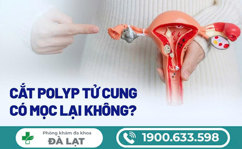 Hình ảnh minh họa